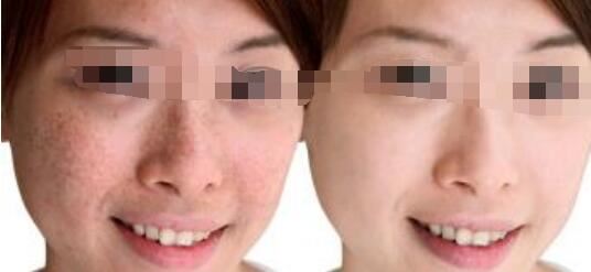 秦志强