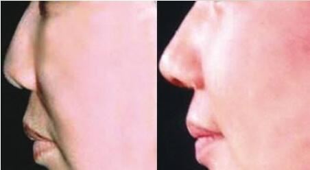 王玉婷