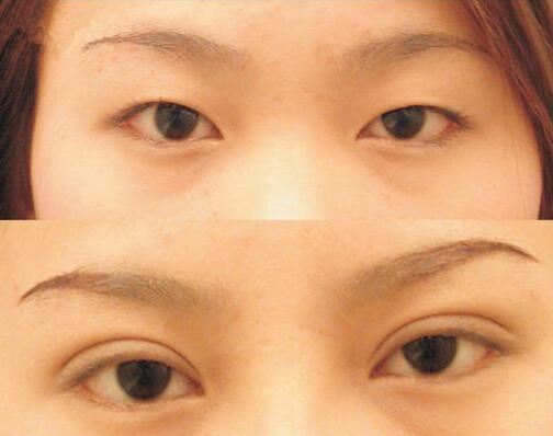 王玉婷