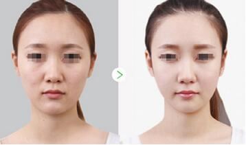王玉婷