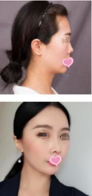 郭新志
