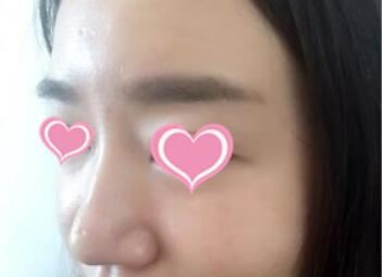 李元石