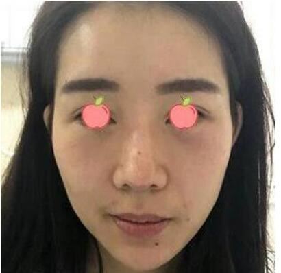 陈远海