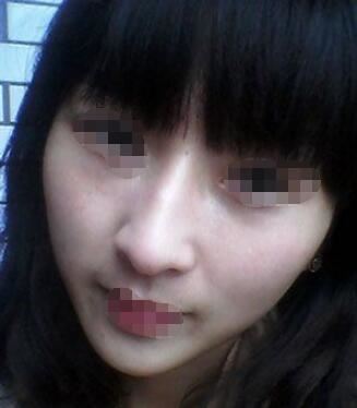 邹佳