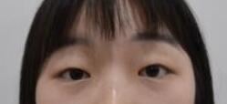 郭晓东