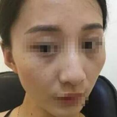 林蕾