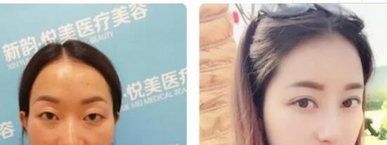 陈秀芸