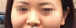 袁娜