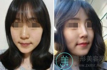 李鹏辉