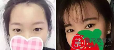 李鹏辉
