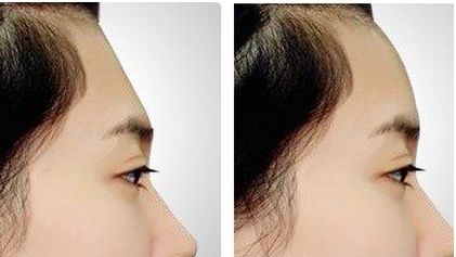 李鹏辉