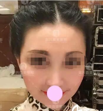 陈卫玲