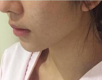 王丹丹