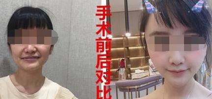 郭东超