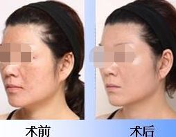 王艳