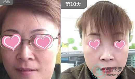 徐佳