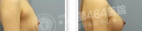 刘旺