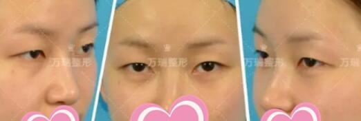 王宝林