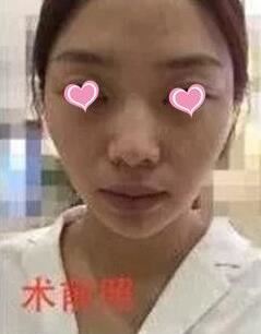 张志宏