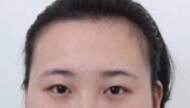 张少林
